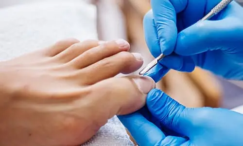 Studio Kinesthetic - Medicinski pedikir